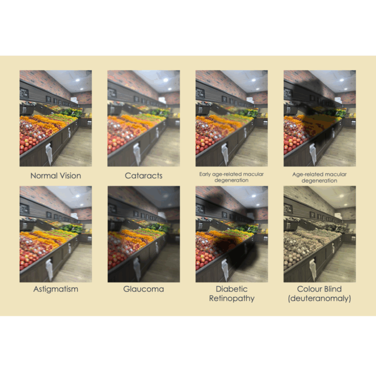 A chart showing different types of low vision